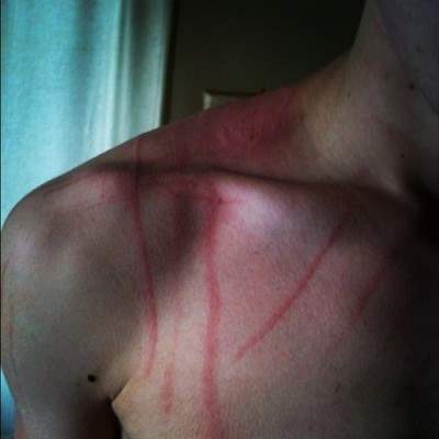 Mulher agride marido com socos, mordidas e arranhões