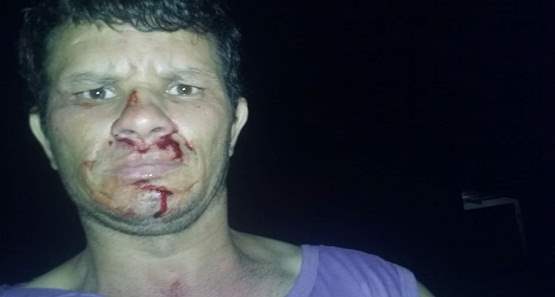 Radialista sofre assalto e entra em luta corporal com criminoso em Candeias do Jamari