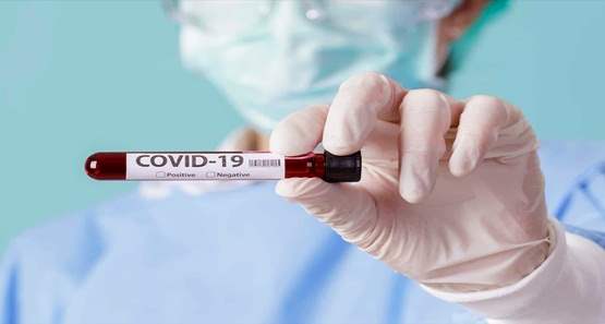 Rondônia registra 1.624 novos casos da covid-19 e 55 óbitos nas últimas 24 hs