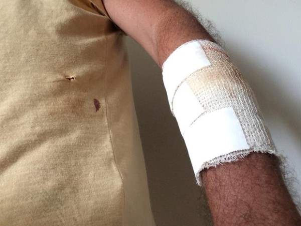 Homem leva facada no braço ao tentar separar briga em casa noturna
