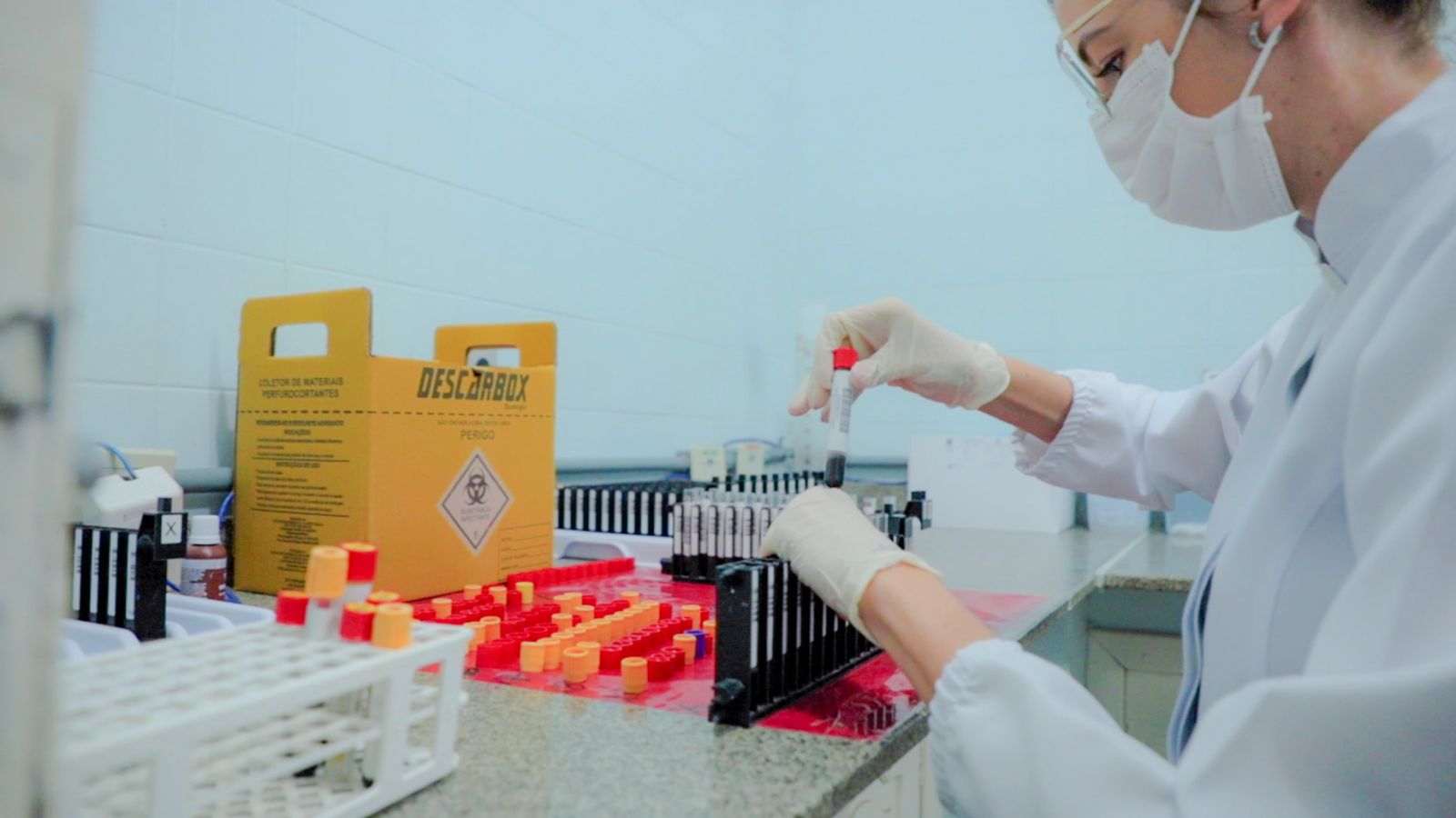 Prefeitura oferece exames laboratoriais em 17 unidades de saúde
