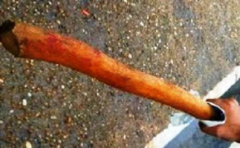 Padrasto agride enteada com pedaço de madeira e deixa lesionada