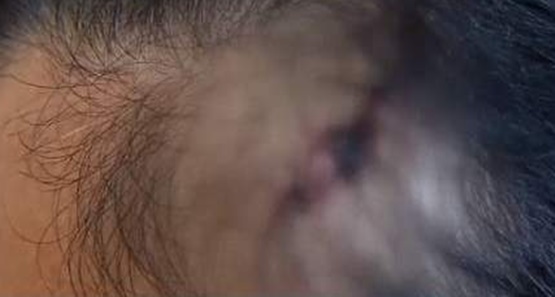 Comerciante é agredida com coronhada na cabeça durante assalto na capital 
