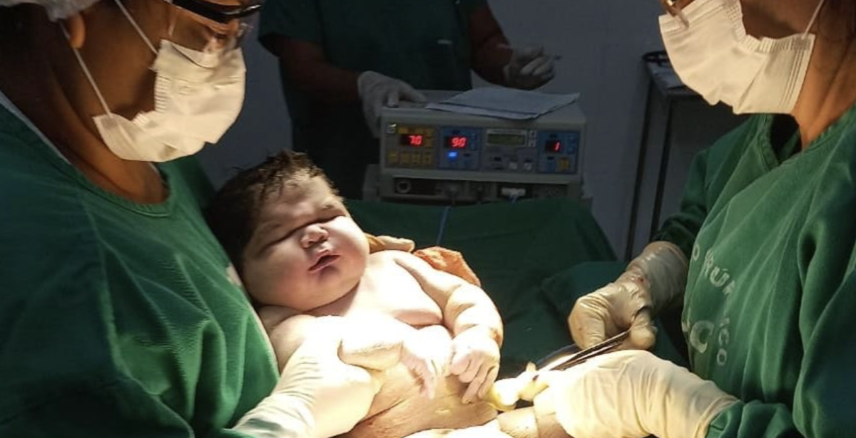 Menino Nasce Com Quase 8kg E Considerado Um Dos Maiores Beb s Nascido 