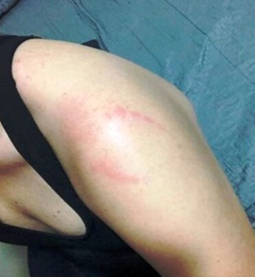 Homem é preso por morder a mulher, após ex mandar mensagem para ela