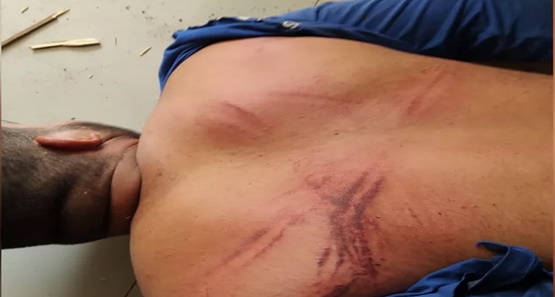 Homem denuncia policial civil e é sequestrado e atacado a pauladas na capital