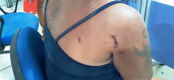 Marido é preso após espancar a mulher e bater a cabeça dela na parede