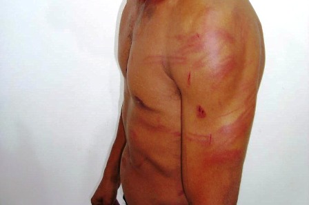 Enquanto rebocava parede, marido é chamado de corno e agredido pela mulher