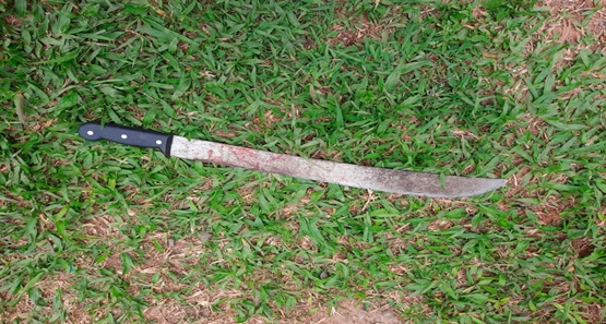Briga entre irmãos termina com um deles lesionado no braço e cabeça com facão 