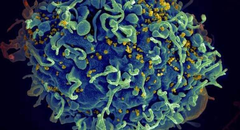 
Homem de 53 anos é o quinto paciente curado do HIV após transplante de células-tronco