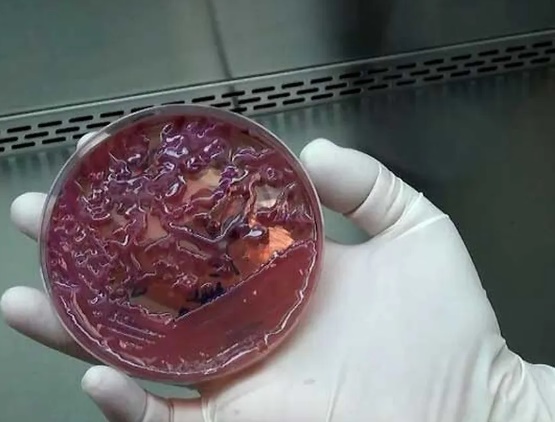 

Superbactéria que matou 5 bebês é considerada praga em hospitais; entenda