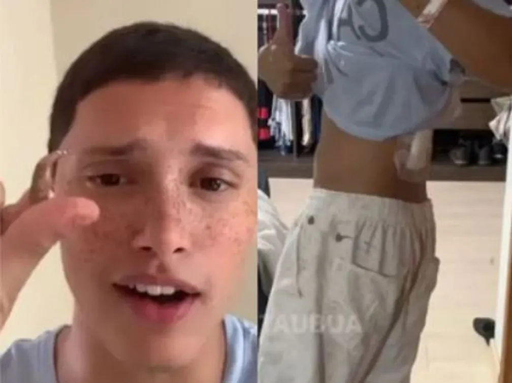 'Acordei e tinha uma bala nas minhas costas', diz jovem baleado dentro de casa