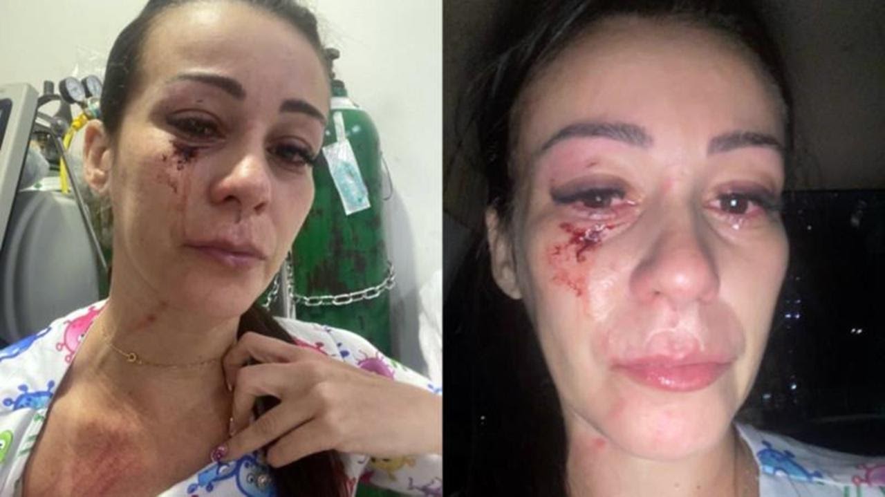 Enfermeira é agredida brutalmente durante plantão em hospital municipal 
