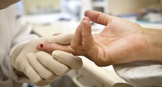 Casos de sífilis e de HIV/aids aumentam entre homens jovens
