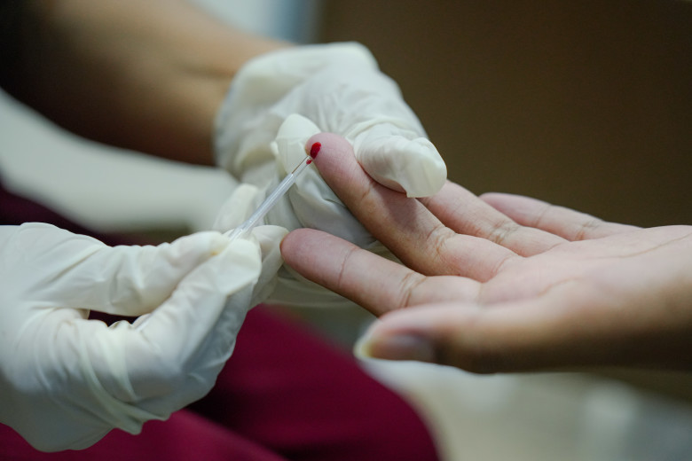 Prefeitura de Porto Velho intensifica ações de combate ao HIV 
