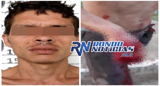 Pérola chega em casa baleado mas não diz quem cometeu o crime