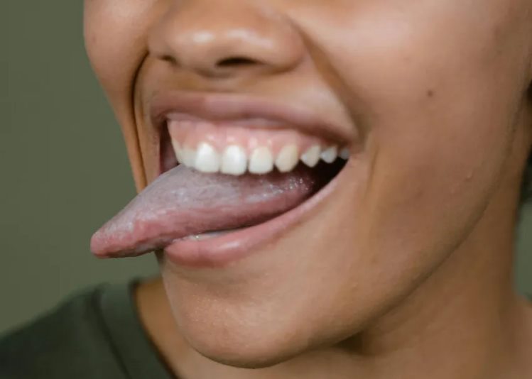 Saiba qual a importância da língua para ter uma boa saúde
