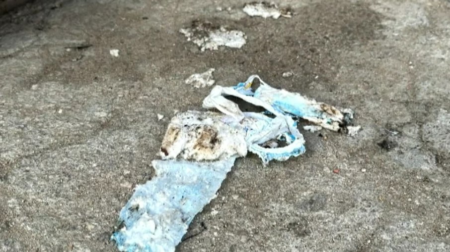 Bebê morre com 90% do corpo queimado após explosão com álcool em casa
