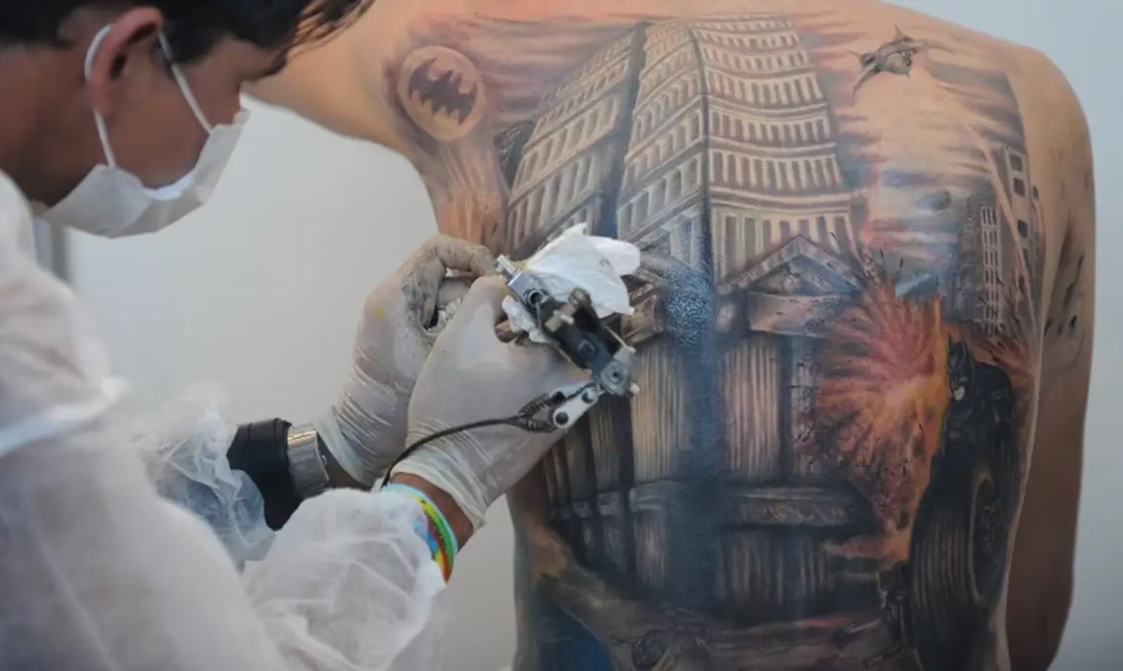 CFM publica resolução que proíbe anestesia geral e sedação para tatuagens
