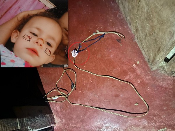 Criança de dois anos morre após sofrer descarga elétrica em residência

