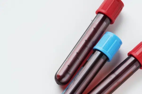 Falso positivo em exame de HIV não gera dever de indenizar
