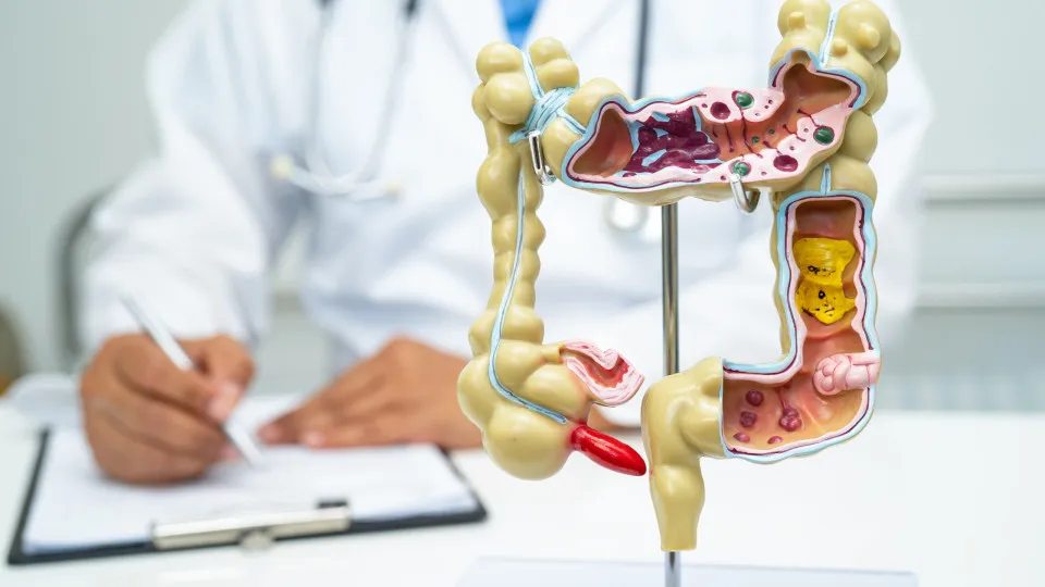 Alimento reduz em 20% o risco de câncer de intestino, revela estudo
