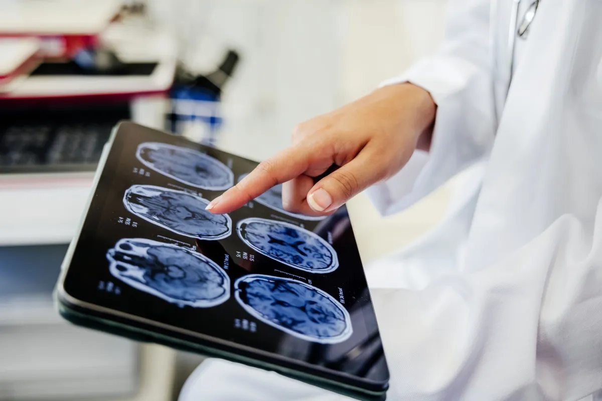 Cirurgia cerebral pode tratar depressão resistente; entenda como funciona
