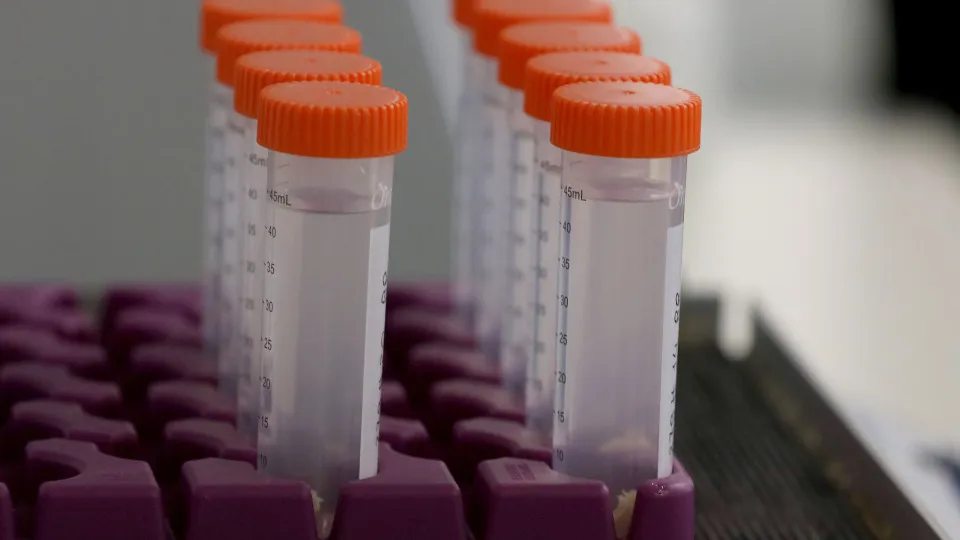 Estudo revela que reposição de vitamina C no cérebro atrasa Alzheimer
