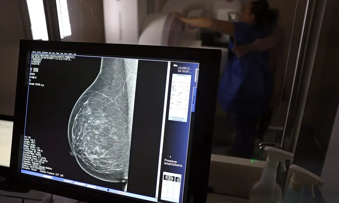 Falta de acesso a mamógrafos limita prevenção do câncer de mama
