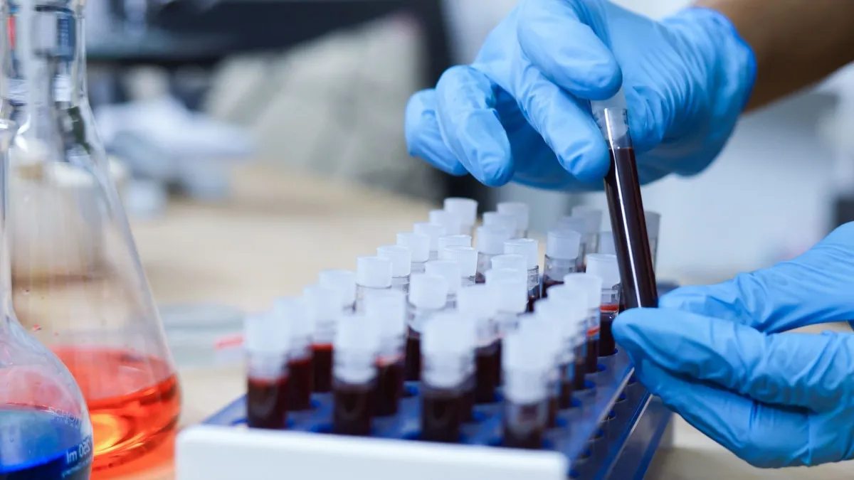 Exame de sangue para Alzheimer auxilia no diagnóstico precoce e tratamento
