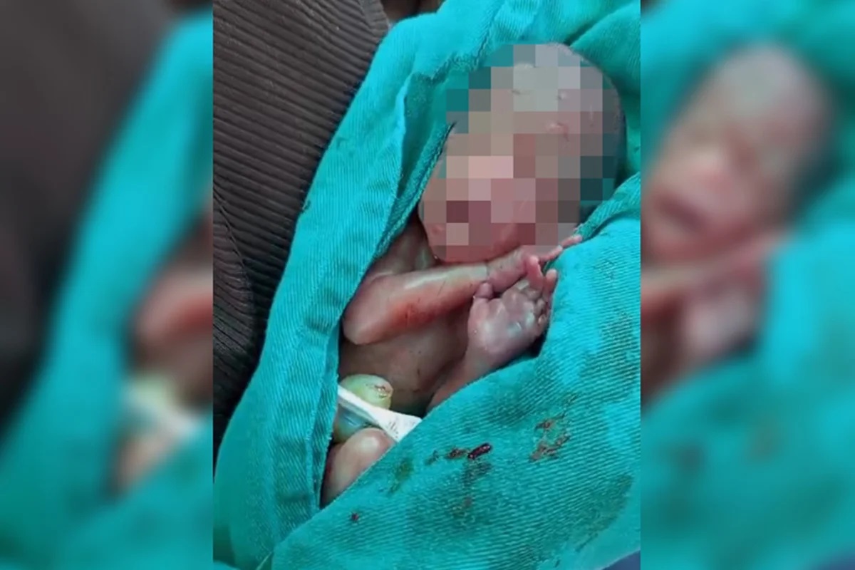 Bebê dado como morto "acorda" no meio do velório em casa: “Chorou no caixão”