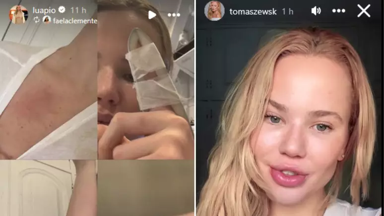 Luana Piovani compartilha supostas provas de agressão de Dado Dolabella à namorada