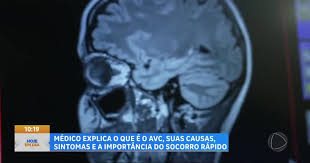 Casos de AVC crescem entre pessoas com menos de 60 anos no Brasil
