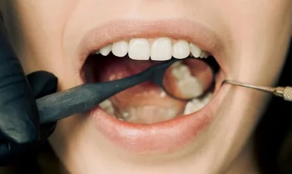 Estudos revelam que uso de maconha pode afetar saúde bucal