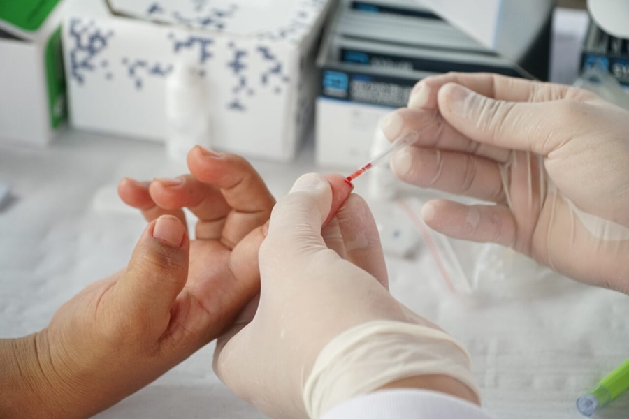 Sesau orienta sobre diferença entre HIV e AIDS, e como prevenir e tratar o vírus