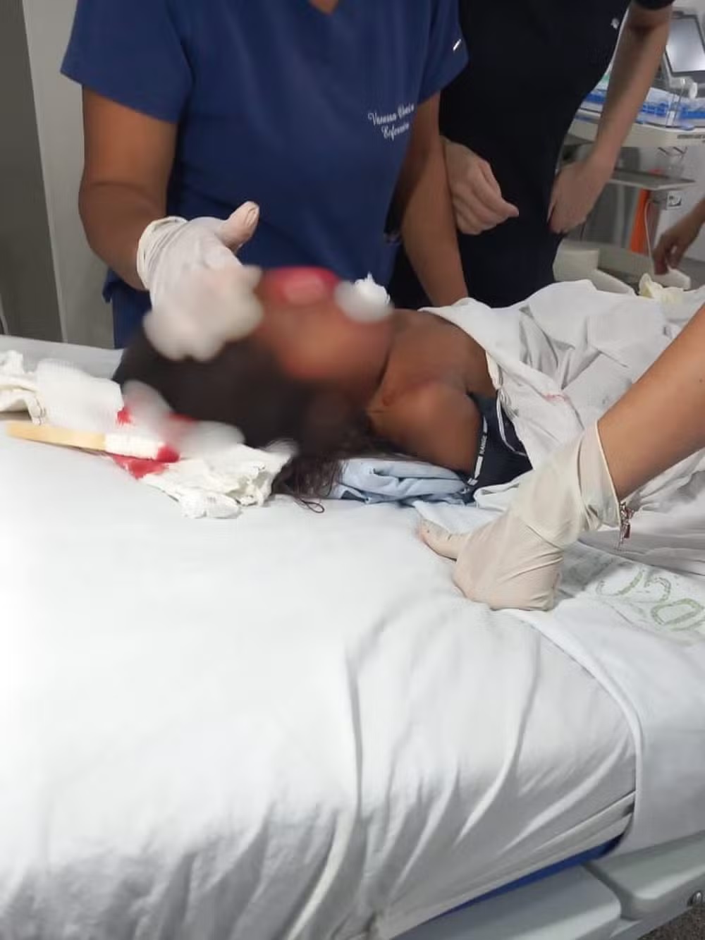 Criança de três anos é baleada no rosto durante troca de tiros em Rondônia
