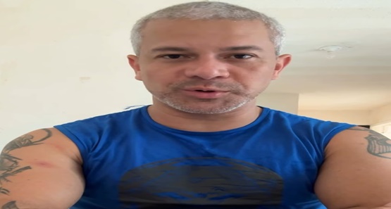 Servidor do Detran-RO confirma diagnóstico de Mpox e relata caso nas redes sociais