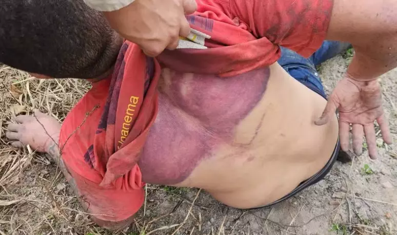 Motorista de aplicativo é sequestrado e torturado após ser confundido com informante da polícia