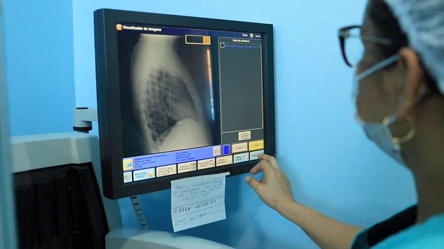 Prefeitura de Porto Velho alerta para prevenção e tratamento da tuberculose