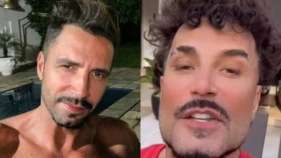 Cantor Latino choca ao aparecer com rosto todo harmonizado: "Nem parece"
