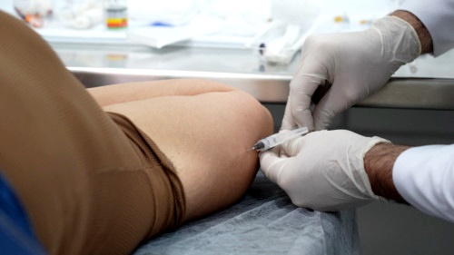 Novo mutirão amplia acesso ao Implanon e reduz fila de regulação