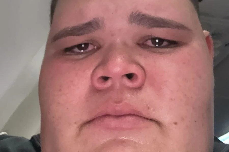 Gordão da XJ é internado, revela cirurgia delicada e agradece apoio da noiva no hospital
