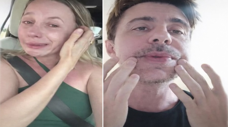 Paciente de RO denuncia paralisia facial após procedimento com dentista 