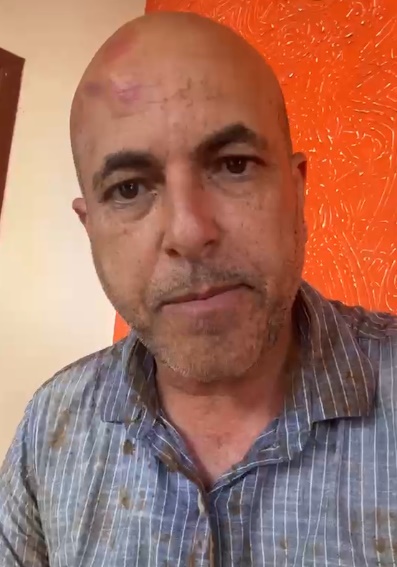 Após sofrer acidente na BR-429, deputado Ismael Crispin conta como tudo aconteceu