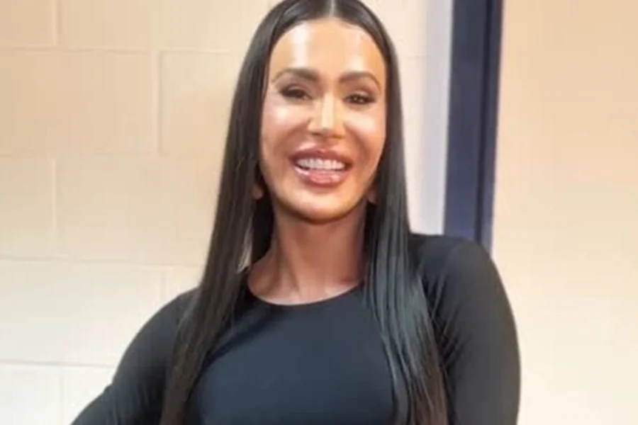 Gracyanne Barbosa abre o jogo sobre uso de caneta emagrecedora: "Para um trabalho"
