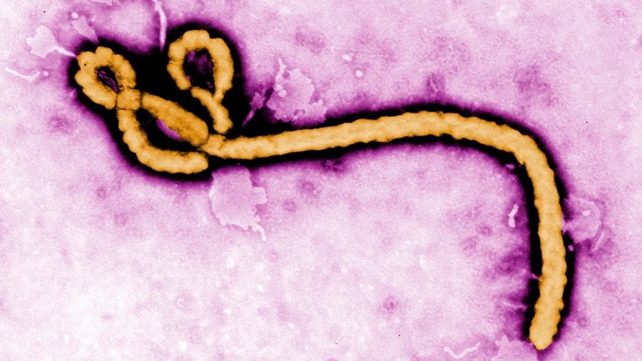 Paciente com suspeita de Ebola é internado em SP