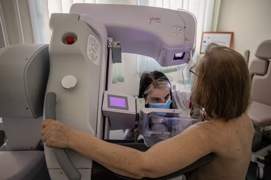ANS defende que plano cubra mamografia digital sem restrição de idade