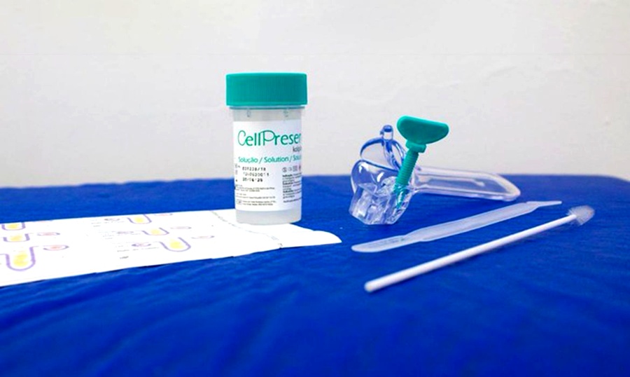 SUS detecta quase 10 mil testes positivos para HPV de alto risco