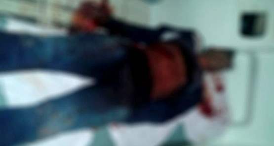 Mulher esfaqueia marido nos testículos para se defender de agressão