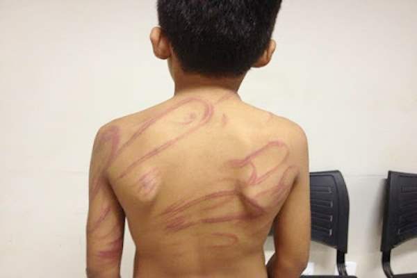 Criança de 11 anos é hospitalizada após ser agredida a pauladas pela mãe